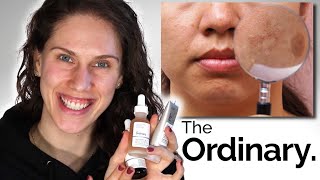 THE ORDINARY  3 BEST DARK SPOTS amp PIGMENTATION PRODUCTS [upl. by Iggem529]