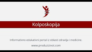 Kolposkopija [upl. by Assetnoc]