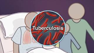 Contact Investigation for Tuberculosis [upl. by Adlecirg353]