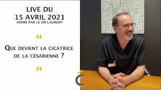 La chirurgie du ventre ou abdominoplastie  Dr Frédéric Laurent [upl. by Maidel]