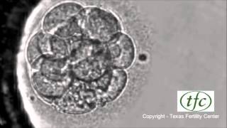 Human Embryo Growing from Fertilization to Day 6 Blastocyst [upl. by Wood491]