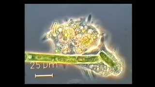 Amoeba eating a green algae [upl. by Arok]