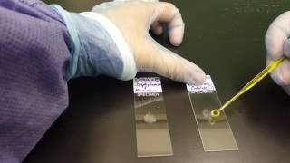 Microbiology the Catalase test [upl. by Seraphina]