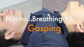 Sudden Cardiac Arrest SCA and Agonal Breathing Gasping [upl. by Hobie165]