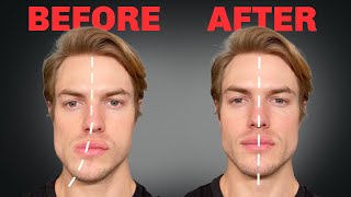 How to Fix Asymmetrical Jaw amp Face FOREVER [upl. by Ajiam]