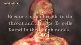 Symptoms of Mono  Mono Symptoms  Infectious Mononucleosis Disease [upl. by Leunas115]