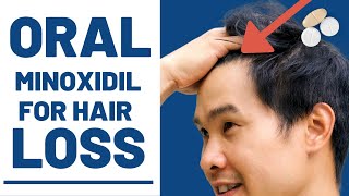 Oral Minoxidil  How Effective Is it REALLY [upl. by Nagirrek]