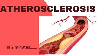 Atherosclerosis in 2 minutes [upl. by Arua]