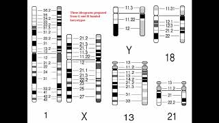 Cytogenetics II Chromosome Analysis amp Karyotypes [upl. by Anifad]