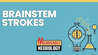 Brainstem Stroke Mnemonics Memorable Neurology Lecture 15 [upl. by Lehrer991]