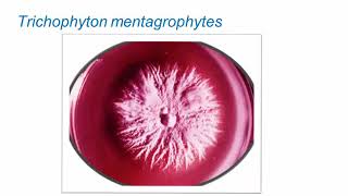 Superficial Fungal Infections Dermatophytes Part 2 Hot Topic [upl. by Nolaf]