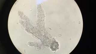 HD Amoeba at 40x 100x 200x and 400x [upl. by Assil732]