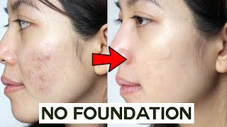 How to Cover Acne amp Blemishes WITHOUT Foundation • easy amp non cakey [upl. by Oramug]