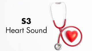 S3 Heart Sound  MEDZCOOL [upl. by Clotilda]