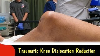 Traumatic Knee Dislocation ReductionQuick Version [upl. by Joelly]