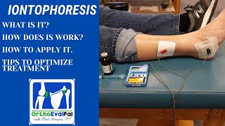 Iontophoresis for Inflammation with OrthoEvalPal [upl. by Pacificas]