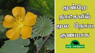 மூன்றே நாட்களில் மூல நோய் குணமாக  Thuthi ilai uses in Tamil  Abutilon Indicum for Piles [upl. by Notsag]