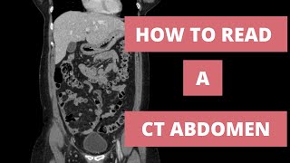 How to read a CT Abdomen for Med students and Residents  Part 1 [upl. by Belen]