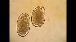 Hookworms in dogs  Ancylostoma caninum Flotation method [upl. by Egwin]