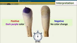 Oxidase Test Five Methods [upl. by Haonam]