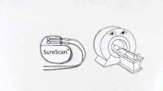 Medtronic SureScan Technology [upl. by Woods]