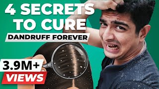 4 SECRET Tips To Remove Dandruff Forever  BeerBiceps Health [upl. by Kunin425]