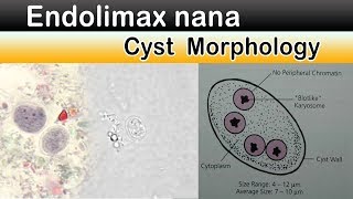 Endolimax nana Cyst Morphology [upl. by Ahsienat243]