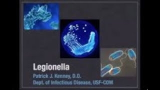 Legionella  Patrick Kenney MD [upl. by Corin234]