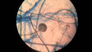 Rhizopus [upl. by Cartwell995]