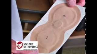 St Cloud Orthopedics  Iontophoresis Medicine Patch [upl. by Roter]