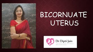 BICORNUATE UTERUS [upl. by Rosmunda]