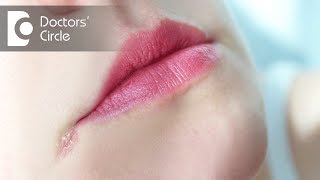 How to manage Angular Cheilitis  Dr Aniruddha KB [upl. by Nolubez]