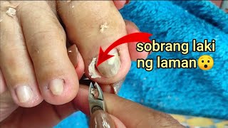 Vlog 119Dry SkinIngrown Removal PEDICURE 24 [upl. by Dianthe423]