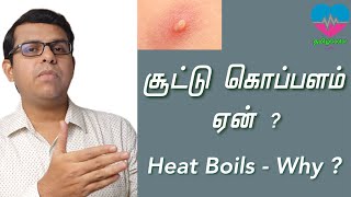 சூட்டு கொப்பளம் ஏன்   Heat Boils  Why  தமிழ் [upl. by Ahsirk]