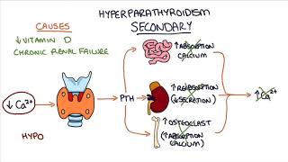 Understanding Hyperparathyroidism [upl. by Ahsitniuq]