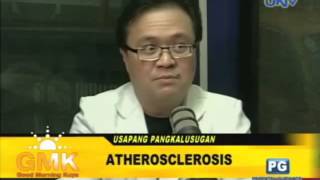 What is Atherosclerosis [upl. by Enoitna]