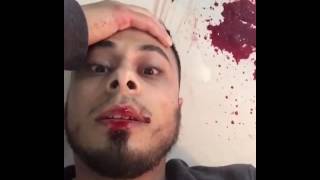 Ali Banat  Last Stage  May Allah Reward Him Ameen [upl. by Acirahs]