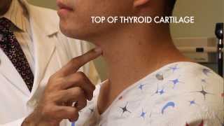 thyroid surgery complications [upl. by Alicsirp]