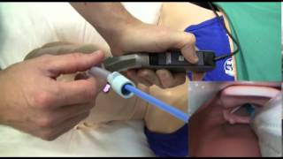 Direct amp Video Laryngoscopy [upl. by Aztiram]