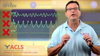 ACLS Adult Cardiac Arrest Algorithm  PEAAsystole [upl. by Reyem]