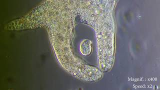 Amoeba eats paramecia  Amoebas lunch   Amoeba Endocytosis  Phagocytosis Part 1  👌 [upl. by Omar]