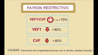 Interpretación básica de espirometría [upl. by Hitchcock667]