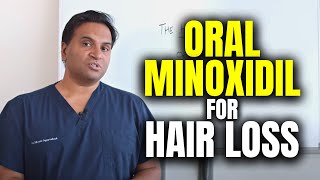 Oral Minoxidil For Hair Loss [upl. by Abbie714]