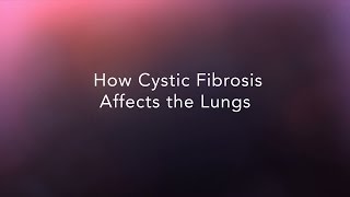 Fibrosis Pulmonar ¿Cómo identificar los primeros signos de la enfermedad [upl. by Dachia239]