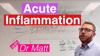 Acute Inflammation  Immunology [upl. by Butler661]