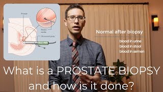 Prostate biopsy procedure explained by urologist [upl. by Savannah]