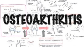 Osteoporosis Pathophysiology  Bone Disorder [upl. by Ahsinauj]