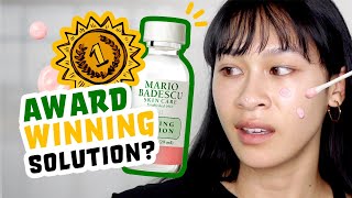 Honest Review 14 days WITH Mario Badescu Drying Lotion [upl. by Reivaxe]