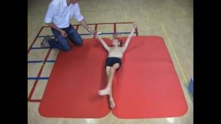 Dyskinetic cerebral palsy case 3 [upl. by Abbi844]