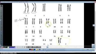 Karyotype analysis [upl. by Yobybab745]